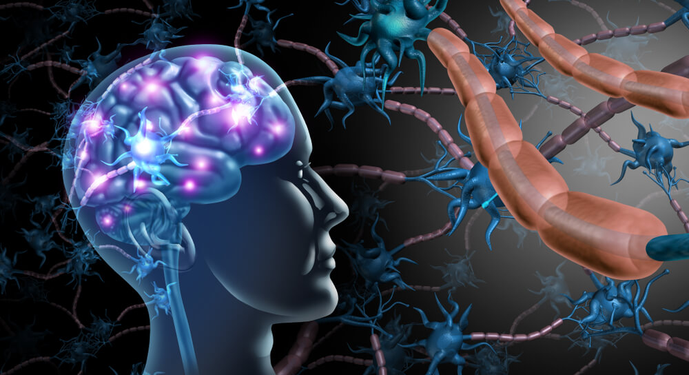 Stem cell transplant – game-changing treatment for multiple sclerosis