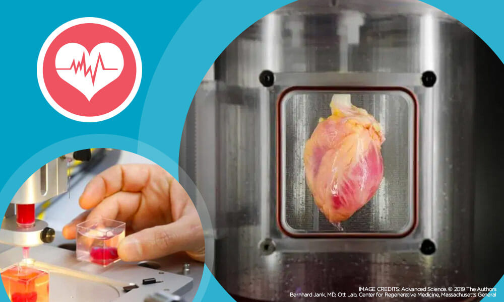 an image of a human heart