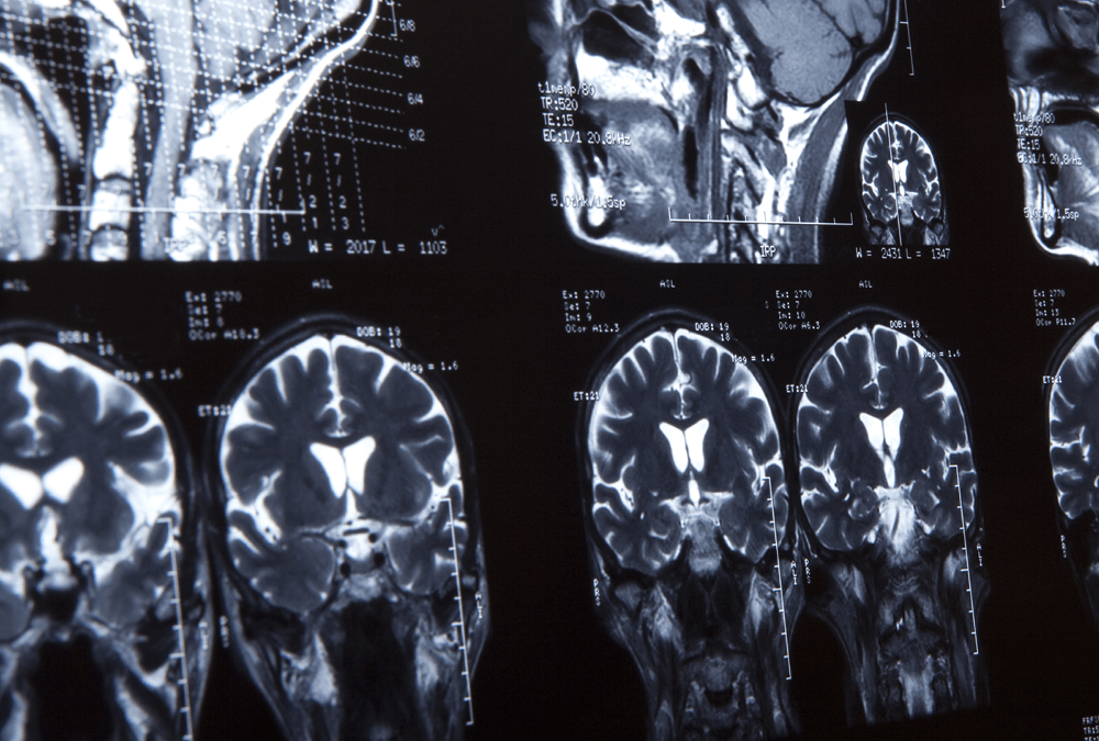 Cranial Scan